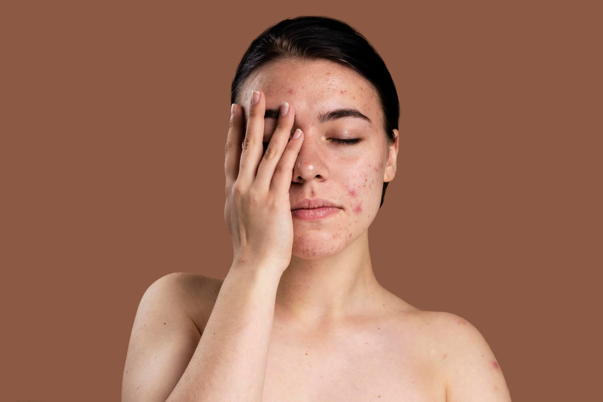 The Pigment Chronicles: Exploring the Levels of Pigmentation and Hyperpigmentation”