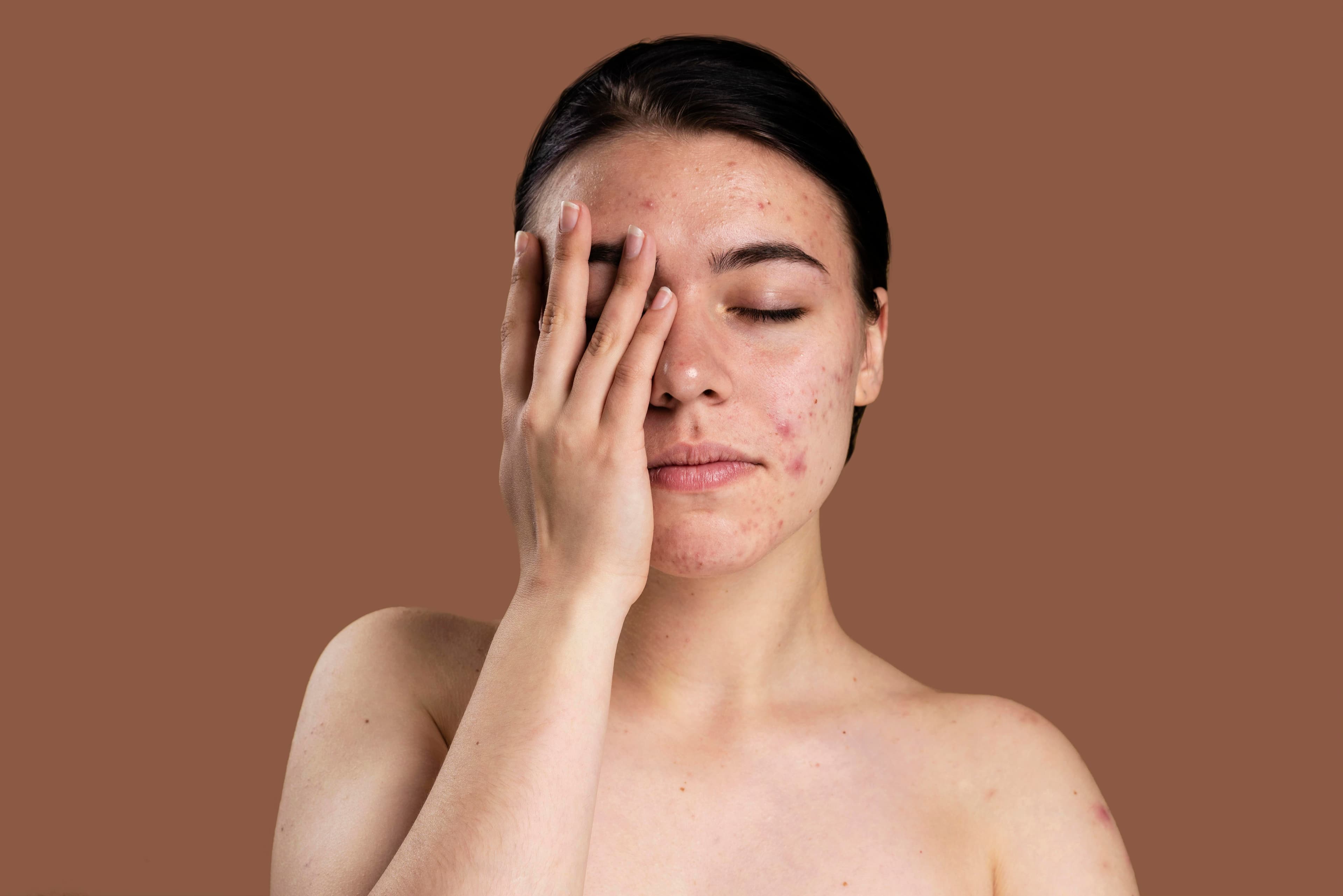 New Look The Pigment Chronicles: Exploring the Levels of Pigmentation and Hyperpigmentation” blog