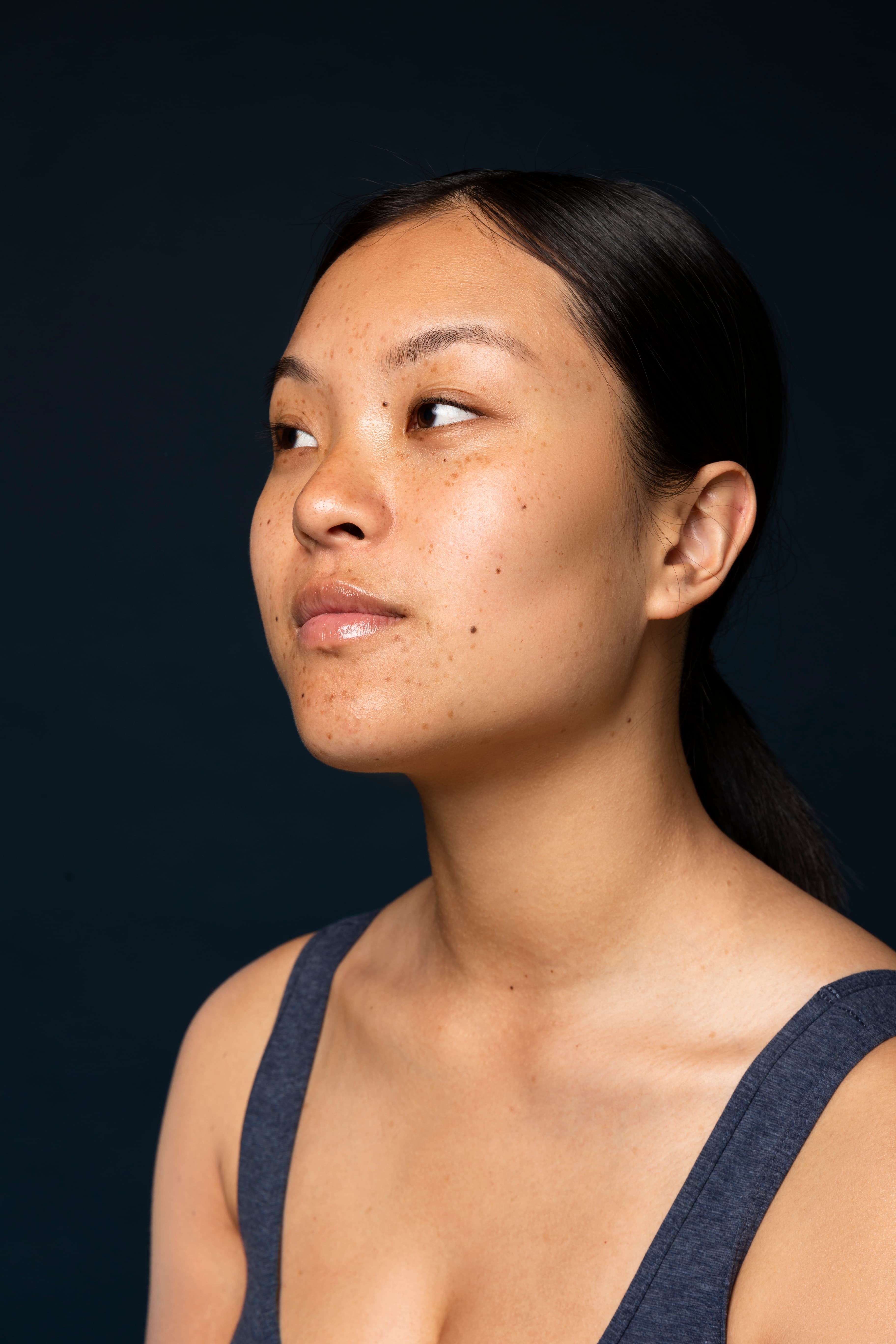 New Look Why Do 1 in 10 Nepalis Get Freckles? Is It Too Much Height? blog